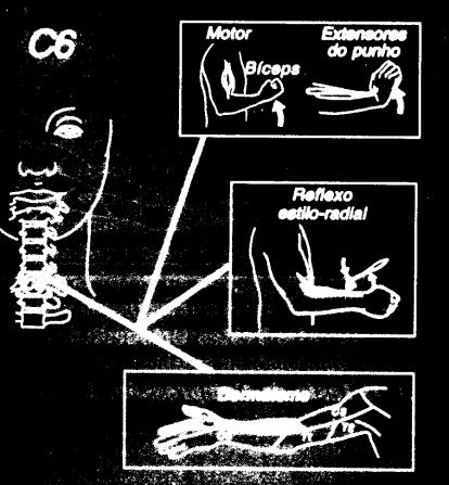 Estilo-Radial DERMÁTOMO: