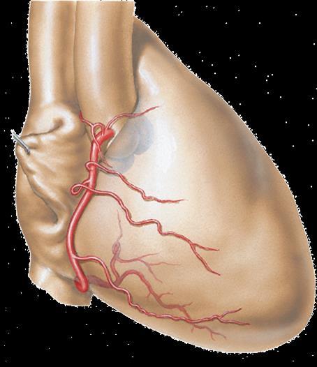 Qual a artéria coronária apresentada?