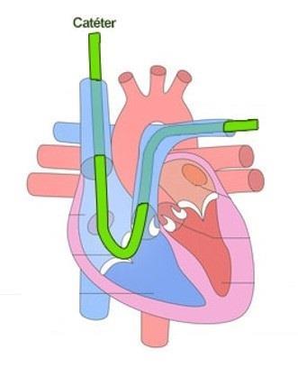 pulmonares?