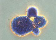 A parede celular de levedura pode aglutinar o Vibrio