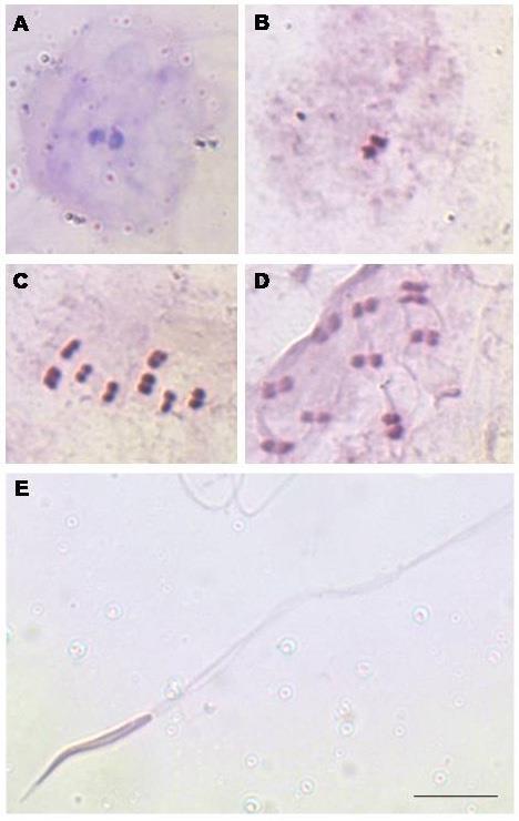 B. Initial prophase; the sex chromosomes were heterochromatic (A) and heteropycnotic (B). C. D.