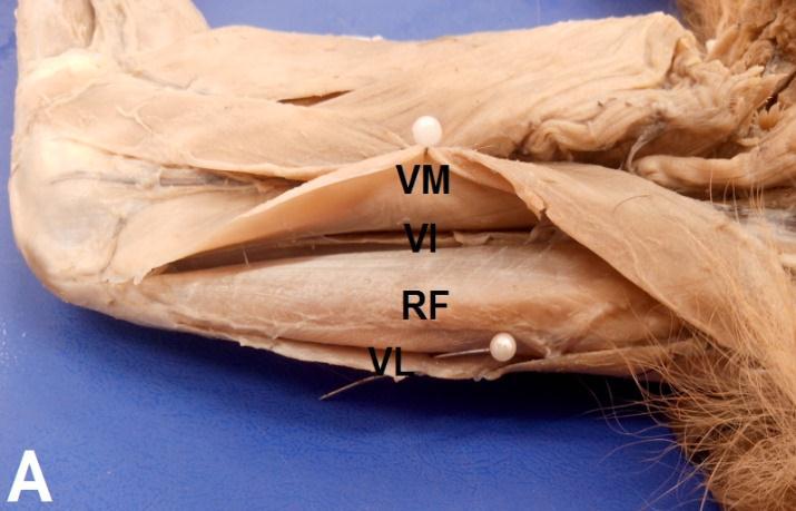 40 O músculo vasto intermédio é menos desenvolvido e tem origem na face cranial lateral de quase toda extensão do fêmur, semelhante ao descrito em equinos (GETTY), inserindo-se no tendão do músculo