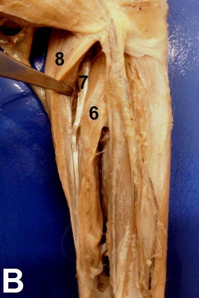 ); * Retináculo inferior dos músculos extensores. 4.1.4 Músculos da região társica, metatársica e falangeana Músculo extensor curto dos dedos Músculo triangular, com um ventre muscular (Figura 7).