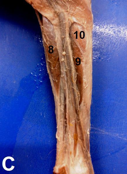 Destacam-se da massa muscular três tendões que se dirigem para os dedos dois, três e quatro, os quais unem-se na expansão extensora, nas falanges distais correspondentes, semelhante ao observado em