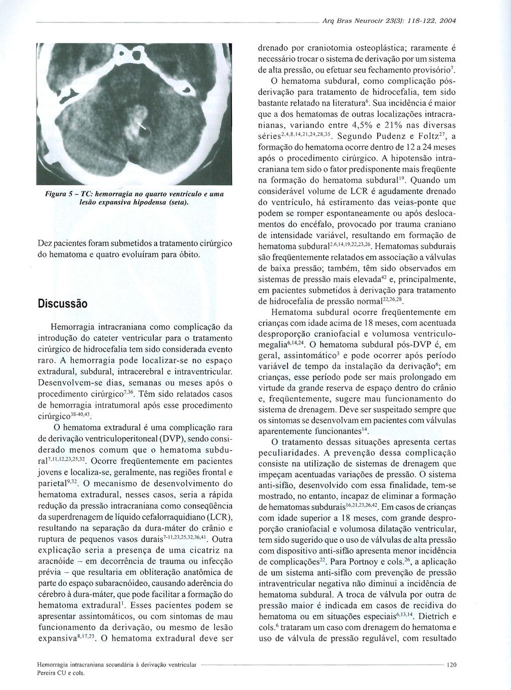 --------------------------- ---- Arq Bras Neurocir 23(3): 118-122. 2004 Figura 5 - TC: hemorragia no quarto ventrículo e uma lesão expansiva hipodensa (seta).