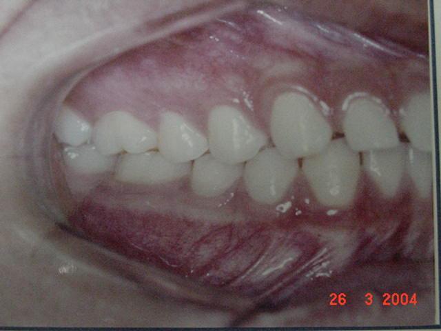 molares relacionam-se