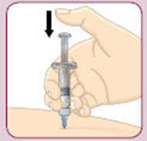 4g Certifique-se que usa a técnica de injeção recomendada pelo seu profissional de saúde. Lembre-se: deve administrar a injeção de BYDUREON imediatamente após a mistura.