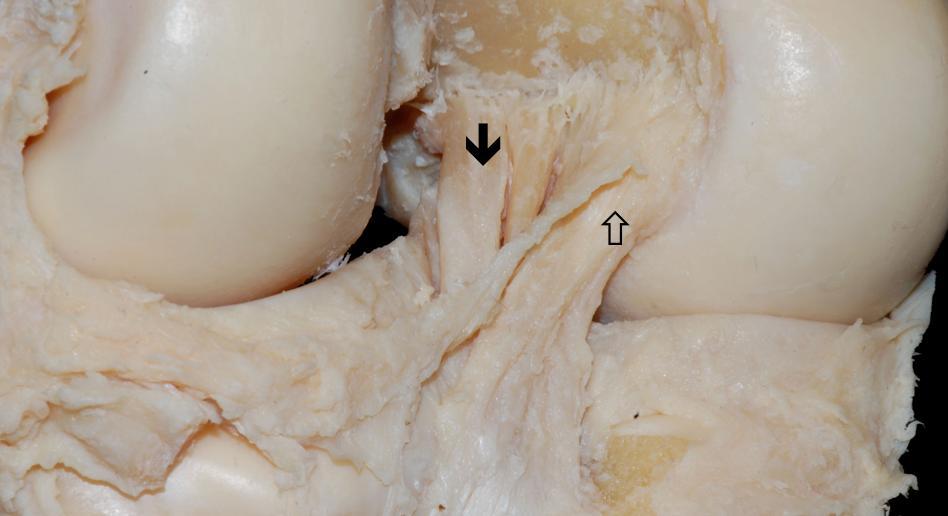 Introdução 22 parâmetros para a nomenclatura das bandas são a origem femoral (anterior ou posterior) e a inserção tibial (lateral ou medial).