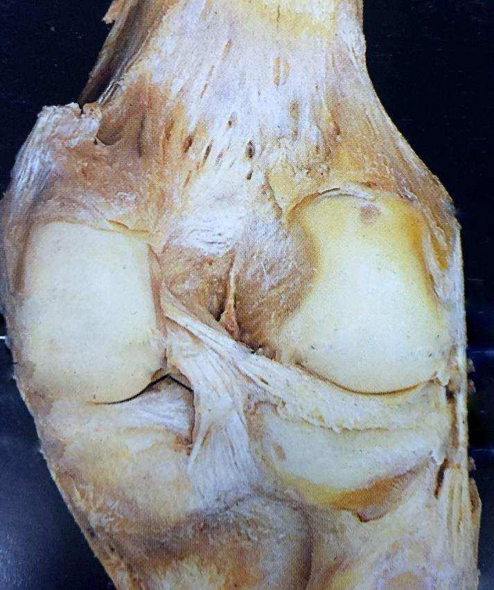 24 Figura 8 Vista Posterior das estruturas articulares do joelho (Rohen, 1998) 1.2.3 Musculatura dos membros inferiores Musculatura Anterior - O grupo do músculo quadríceps é composto de quatro partes distintas que compartilham um tendão comum de inserção (Gray,1988).