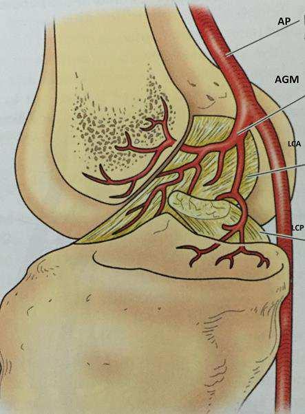 30 Figura 14 Vista medial, artéria genicular medial, ramo para o LCA (Insall, 2012) Figura 15 Artéria poplítea com seus ramos (Insall, 2012) 1.