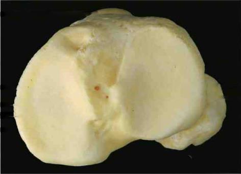 Quais são os ossos representados? Qual a vista e estruturas indicadas? Tuberosidade da tíbia D 7 Platô tibial D.