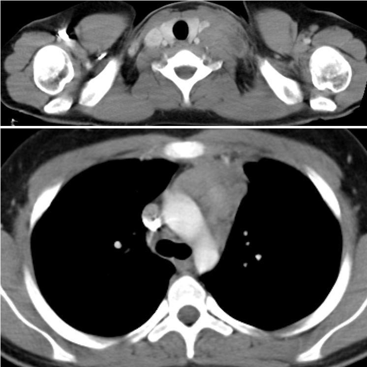 Métodos de Imagem Os métodos de imagem incluem exames de radiologia convencional, como o radiograma simples do tórax, abdómen, osteo-articular e estudos radiológicos do tubo digestivo; a ecografia e