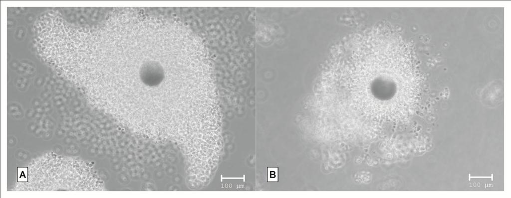 G1 - considered morphologically healthy (oocytes with compact cumulus and more than three cell layers, intact cytoplasm, evenly granular and homogenous coloration) G2 - considered morphologically