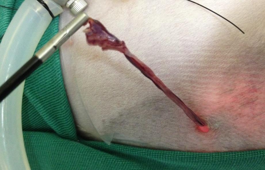 46 Após conclusão da etapa cirúrgica da OVH, a cavidade e sítios cirúrgicos foram reavaliados quanto a alterações e hemorragias para então iniciar os procedimentos de remoção dos tecidos.