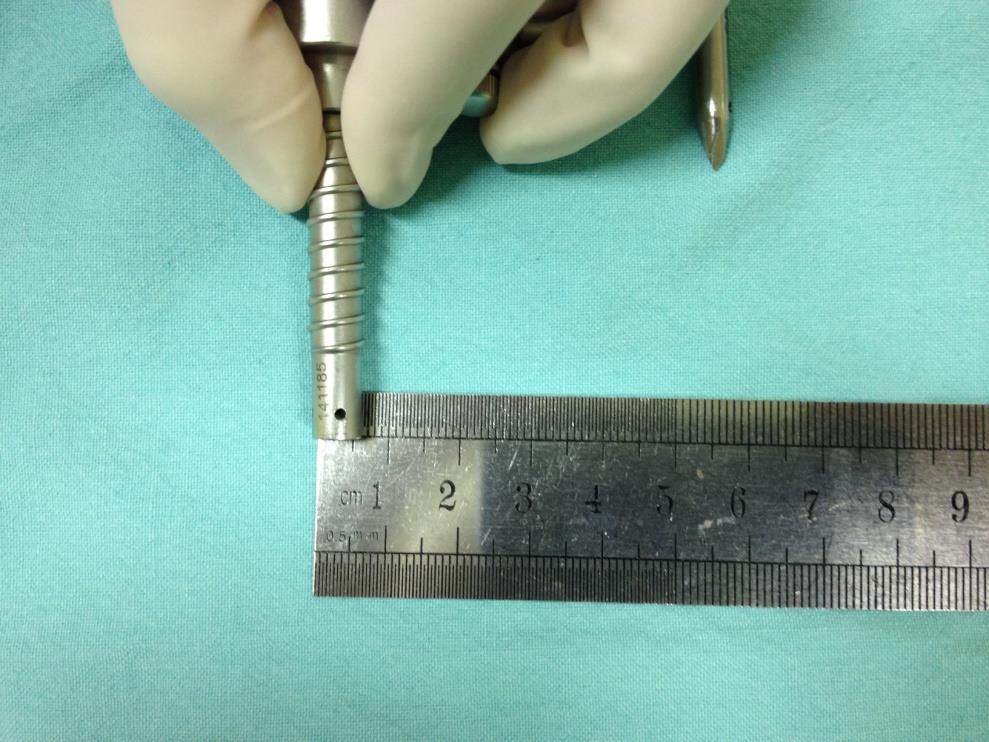 55 Figura 10: diâmetro externo do trocarte de 5 mm utilizado, correspondendo a 6 mm.