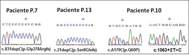 51 5.2.1 NGS DO GENE LEPRE1 As duas alterações mencionadas anteriormente foram mais uma vez encontradas, porém não foi observada mais nenhuma outra mutação na extensão codificante do gene em questão.