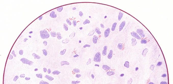 401 Figura 12 Biopsia 6460 Coloração: Escarlate R.