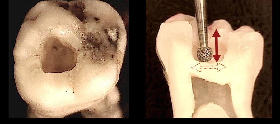 Figura 6 Inicio da cirurgia de