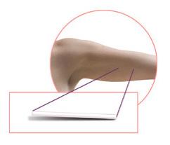 Implante de progestativo - Implanon É constituído por uma cápsula com a forma e dimensão de um fósforo que se insere sob a pele do braço.