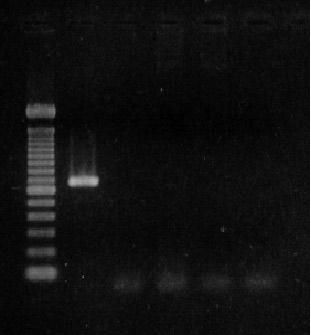 726 SANTANA, A. P. et al. vis, de 60-kDa (SUAREZ et al., 1991; FIGUE- ROA et al., 1993); gene BabR gene de B. bovis (MCLAUGHLIN et al., 1992); gene Bv80 de B. bovis ( BROWN et al.