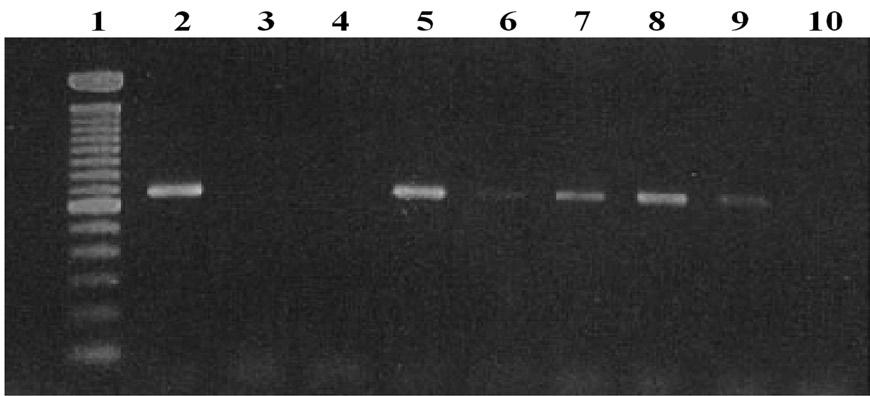 Dinâmica da infecção natural por Babesia bigemina em bezerros a partir do nascimento... 727 se que a PCR foi capaz de detectar DNA de B.