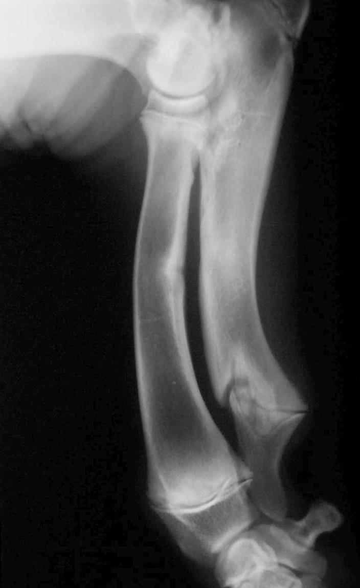 da ulna -