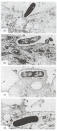 Vacina de subunidade recombinante E. coli invasion Qual subunidade utilizar?