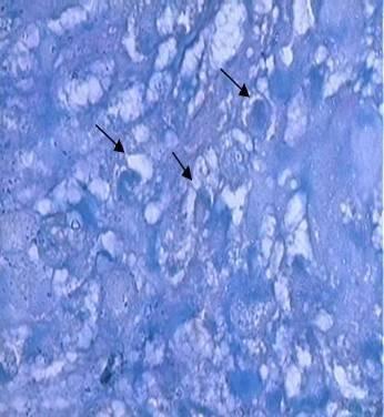 Foi possível detectar a presença dos mucopolissacarídeos da matriz intracelular em duas das três amostras induzidas (Figura 5A e B).