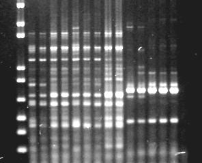 M 1 2 3 4 5 6 7 8 9 10 11 12 13 14 15 2000 pb 1000 pb 500 pb FIGURA 1 - Produto da amplificação do DNA de isolados de Ralstonia solanacearum por PCR-ERIC.