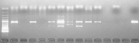 Amostras de coágulos sanguíneos (1-10) analisados pela PCR para o gene glta (I) e gene ompb (III) e Southern blotting