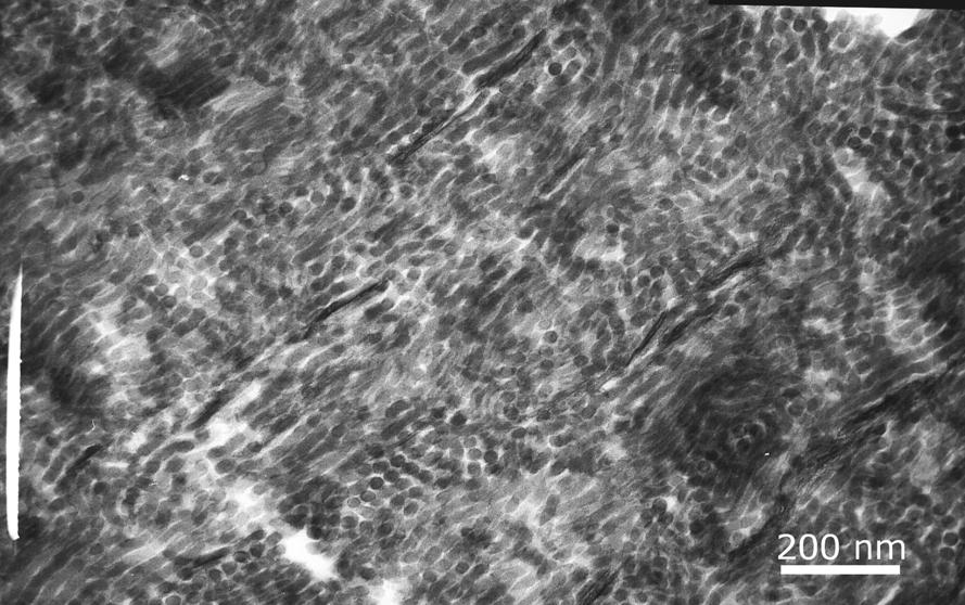 5. Resultados e Discussão 183 Figura 106: Micrografia de TEM da amostra de nanocompósito de SEBS KG 1652 + 5%15A preparado por masterbatch tingida com RuO 4.