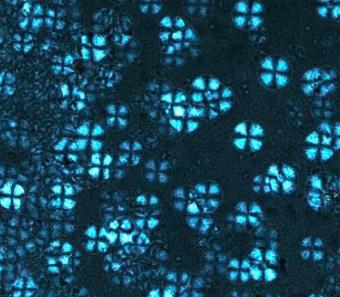 Figura 10 Imagem de microscopia de esferulitos. Adaptado de [16] 2.1.4 O processo de cristalização O processo de cristalização tem como início a nucleação e tem continuidade com o crescimento de grão.