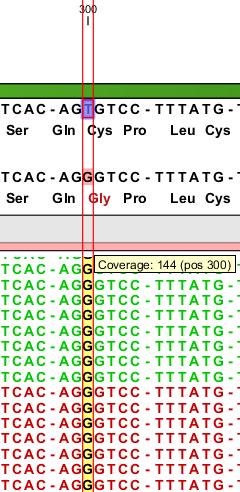 41 A B Figura 6 - Representação do alinhamento das sequencias referentes à amostra MJ 2021 ressaltando a região da mutação deletéria c.300t>g; p.c61g.