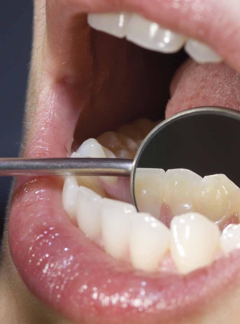 ORAL CARE Oral Care produtos da VOCO para dessensibilização, fluoretação tópica, profilaxia e branqueamento.