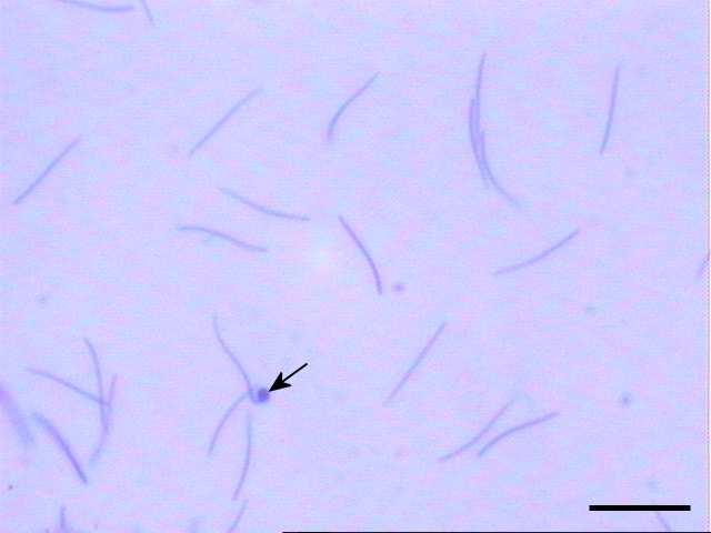 (Barra 10 µm) Figura 2: Esfregaço de sêmen de galo hidrolisado em ácido clorídrico 1N por 10 minutos e corado em cubeta com azul de toluidina 0,025%, ph 4,0 por 20
