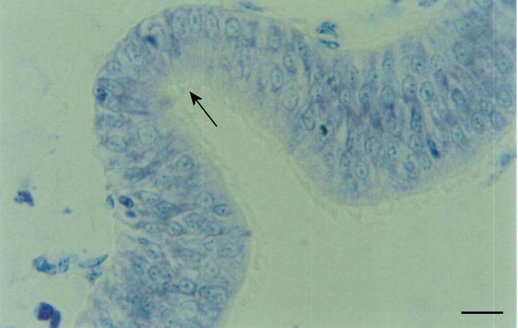 35 Foi feita uma tentativa de isolamento das cabeças a partir dos cortes histológicos da espermateca corados com azul de toluidina.