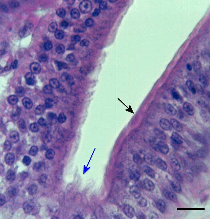 37 os cílios das caudas dos espermatozóides devido à variação de tamanho que estas apresentam, sendo que o tamanho dos cílios é constante.