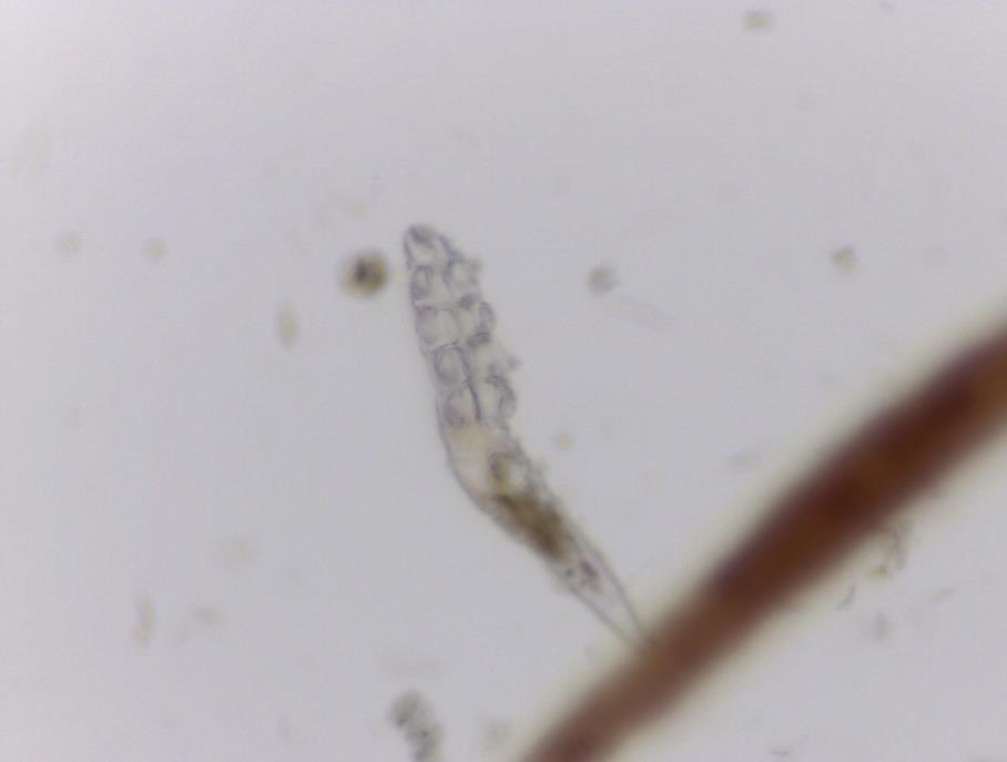 18 Figura 1 Ácaro adulto Demodex spp. Seta preta: gnatossoma. Seta vermelha: podossoma. Seta verde: opistossoma. Visualização em aumento de 400X. FONTE: A PRÓPRIA AUTORA.