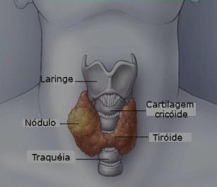 NÓDULOS