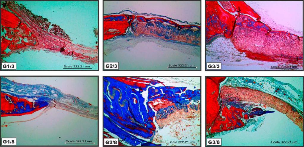 Histologia com Tricrômico de Masson e Picrosirius Red, ilustradas nas Figuras 5 e 6, respectivamente: Figura 5: Eletrofotomicrografias por Microscopia Eletrônica de