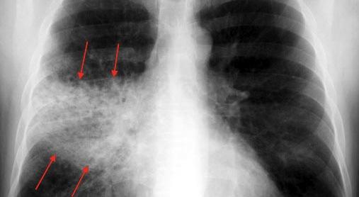 Contraste natural entre tecidos Radiografia de tórax Radiografia de abdome Diagnóstico não invasivo Há alteração?