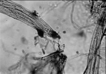 11 A B C I C II Figura 1 - (A) larva de nematóide tricostrongilídeo capturada por armadilha do tipo nódulos adesivos;