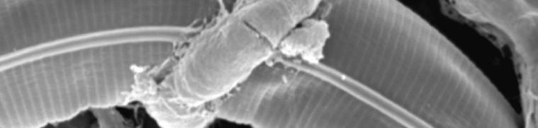 Elétron-micrografias de varredura da interação entre o