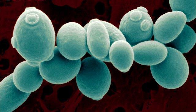 Introdução Saccharomyces cerevisiae Otimização Melhoria da nadegradação maturação da fibra do pela rúmen eliminação pelo estabelecimento da microbiota; do oxigênio dissolvido presente no rúmen e