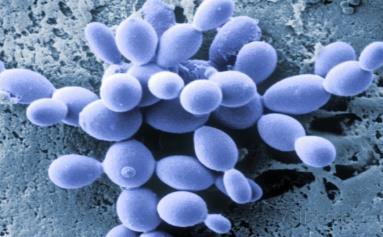 Introdução Saccharomyces cerevisiae