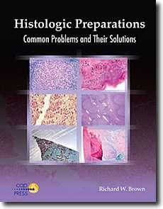 Histologic Preparations: Common Problems and