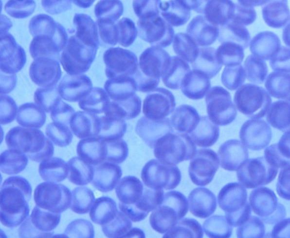 68 A B C Figura 13: Fotomicrografias de distensões sanguíneas