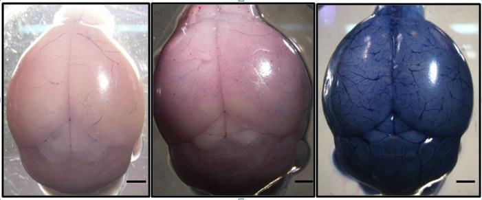 73 A B C Figura 17: Ensaio de Permeabilidade Vascular pelo uso do corante Azul de Evans.