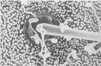 8 Figura 1. Germinação de esporos e formação de apressórios dos conídios de Metarhizium anisopliae, em microscopia eletrônica de varredura (1.