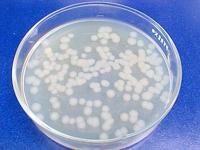 27 Foi pulverizado 0,1 g.l -1 do produto comercial BACULOVIRUS AEE PM. O produto utilizado continha, no mínimo, 7,5 x 10 9 corpos poliédricos de inclusão (CPI).g -1.